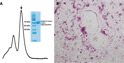 Macrophage Colony-Stimulating Factor M-CSF protein 